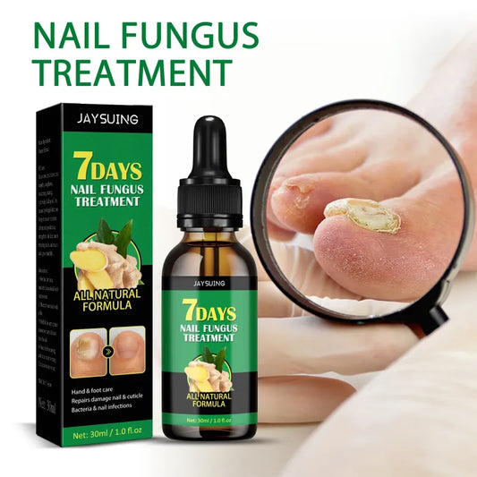 JAYSUING Cuidado de Uñas 30 ml - producto real